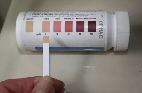 Forum on this topic: How to Read Ketosis Strips, how-to-read-ketosis-strips/ Forum on this topic: How to Read Ketosis Strips, how-to-read-ketosis-strips/