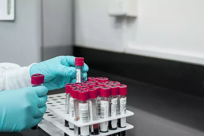 The U.S has an extreme shortage of testing capacity for COVID-19, but new tests on the way from China could detect coronavirus antibodies and determine immunity. - WALLPAPER FLARE