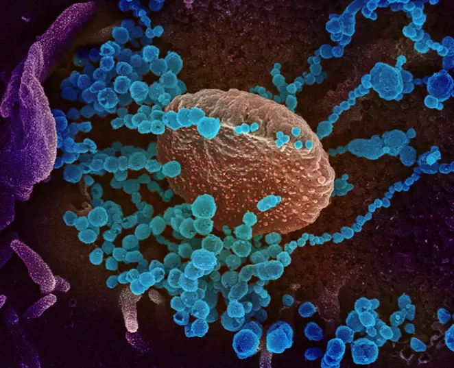 Shortly after Deschutes County reopened into Phase One, cases spiked, though due to the incubation period of COVID-19, opening was likely unrelated to the rise in positive cases. - NATIONAL INSTITUTE OF ALLERGY AND INFECTIOUS DISEASES