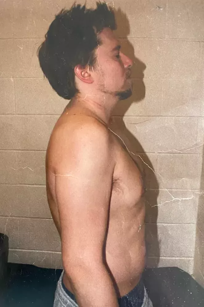 Wirkkala shared this photo with the Source Weekly, displaying some of the wounds he sustained the night of the alleged attack by David Ryder. - SUBMITTED