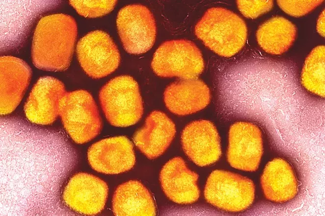 Monkeypox cells photographed by NIAID Integrated Research Facility in Fort Detrick, Maryland. - COURTESY OF NIAID