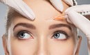 Botox vs. Fillers: Which Is Right for You?