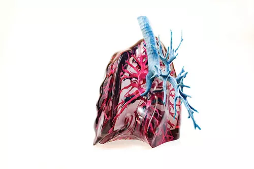 A lung model created by Mediprint for physicians at Memorial Sloan Kettering Cancer Center. - ROY GUMPEL