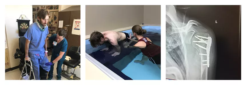 Images of Andrew Bernstein during rehabilitation, as well as an X-ray showing damage to his shoulder. - COURTESY OF ANDREW BERNSTEIN