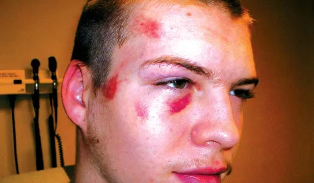 Sixteen-year-old Dalton McDermott was allegedly beaten by guards while jailed at the Sangamon County Juvenile Center in early July.