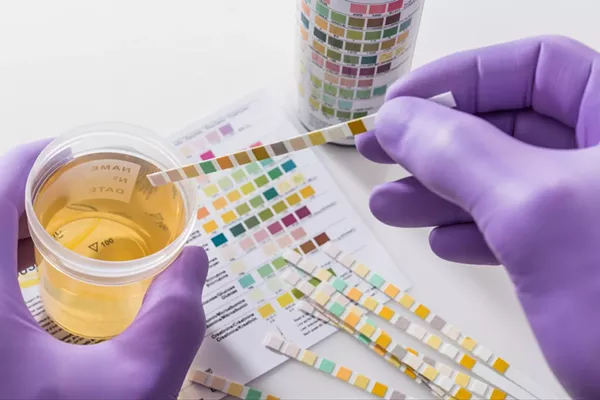 Top 5 Best At-Home Drug Testing Kits - Vimarsana News