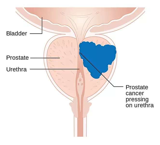 prostate journal