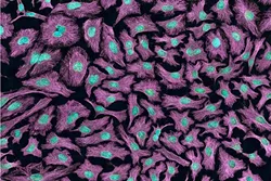 HELA: The now famous HeLa cells taken from Henrietta Lacks’ body have been used to cure polio, study cancer, and develop in vitro fertilization. - PHOTO COURTESY OF CUESTA COLLEGE