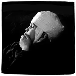 RAW Leon Borensztein captures a poignant moment of his daughter Sharon healing from an injury. - PHOTO COURTESEY OF LEON BORENSZTEIN