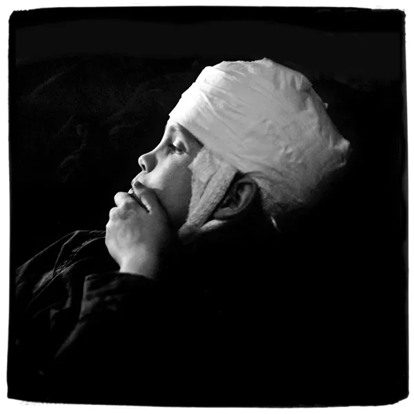 RAW Leon Borensztein captures a poignant moment of his daughter Sharon healing from an injury. - PHOTO COURTESEY OF LEON BORENSZTEIN