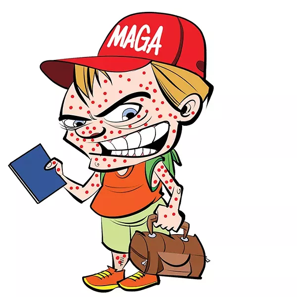 measles_1_.jpg