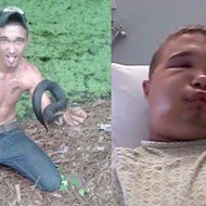 Floridaman tries to kiss venomous snake and is immediately bitten on the lips