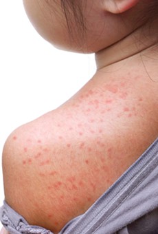 Florida Department of Health says Pasco County measles case has been 'ruled out'