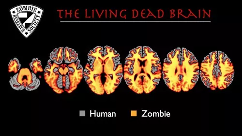 ZombieBrainChart.jpg