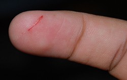 Paper cuts: Hard to stop the bleeding.