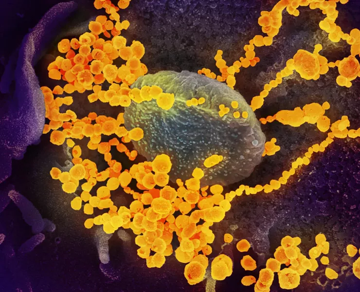 SARS-CoV-2 emerges from the surface of cells cultured in the lab in this scanning electron microscope image. - CREDIT NATIONAL INSTITUTE OF ALLERGY AND INFECTIOUS DISEASES ROCKY MOUNTAIN LABORATORIES