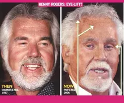 celebrityplasticsurgery.tv