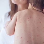 Number of 2019 Measles Cases in Texas Already Higher Than for All of Last Year