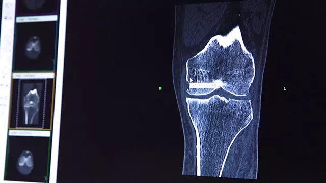 CT scan review