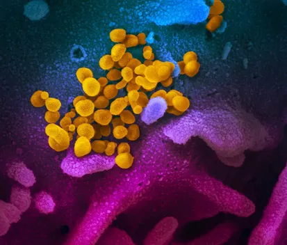 This scanning electron microscope image shows SARS-CoV-2 (yellow)—also known as 2019-nCoV, the virus that causes COVID-19—isolated from a patient in the U.S., emerging from the surface of cells (blue/pink) cultured in the lab. - NIAID-RML