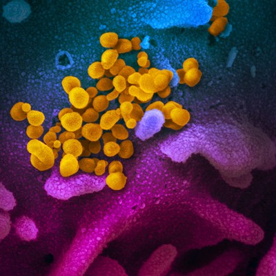 UA, State of Arizona Developing COVID-19 Antibody Tests